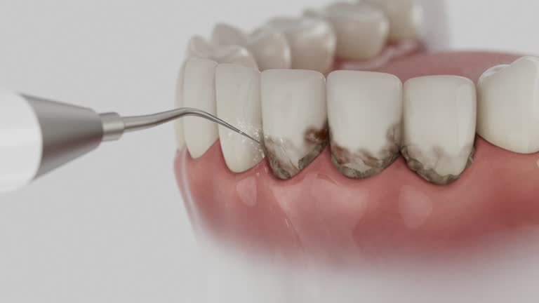 Reliable Dental contractor in Jamestown, OH by Dentist Open Now